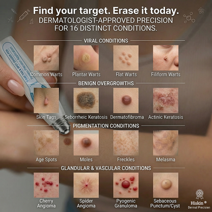 ✨ Exclusive 30% OFF 💎 Official Hiskin® Store | 7-Day Tag & Spot Eraser | Professional-Quality Rollerball | Zero Pain • Zero Scars • Safe for Face & Body